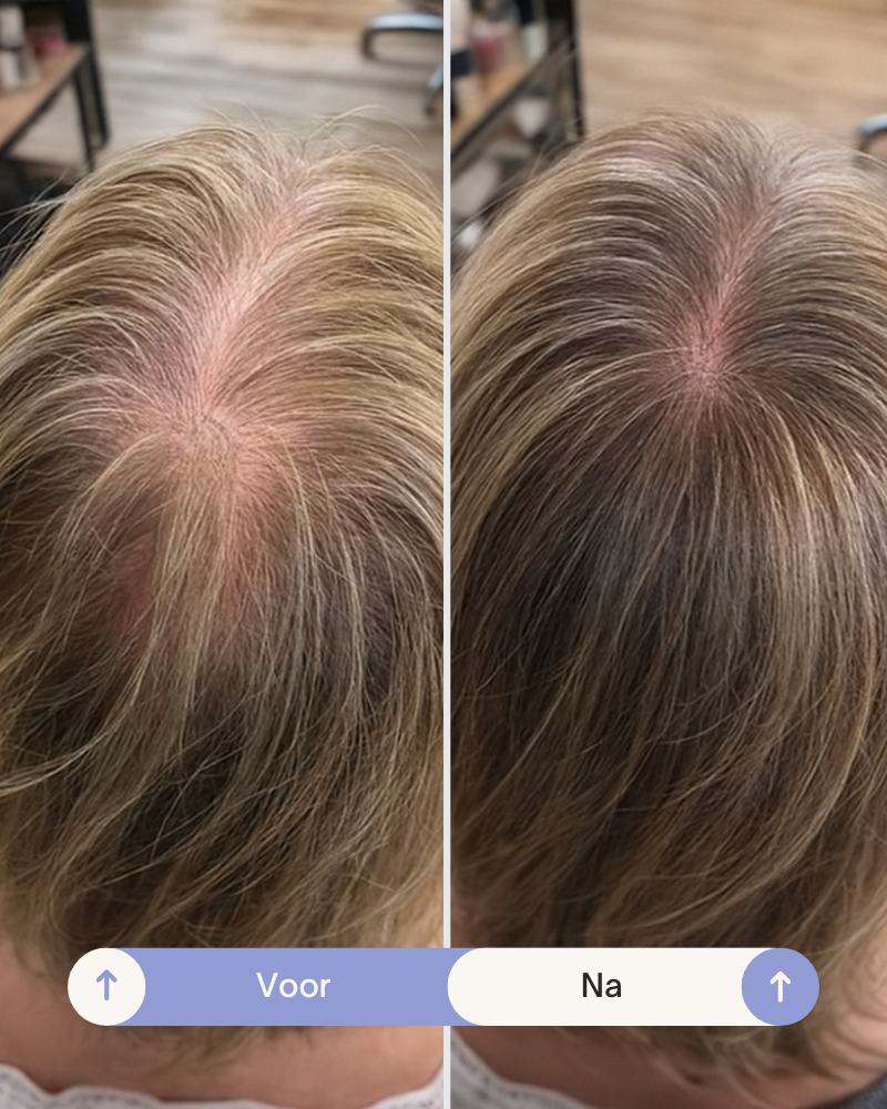 Grow Perfect™ Shampoo - Image 6