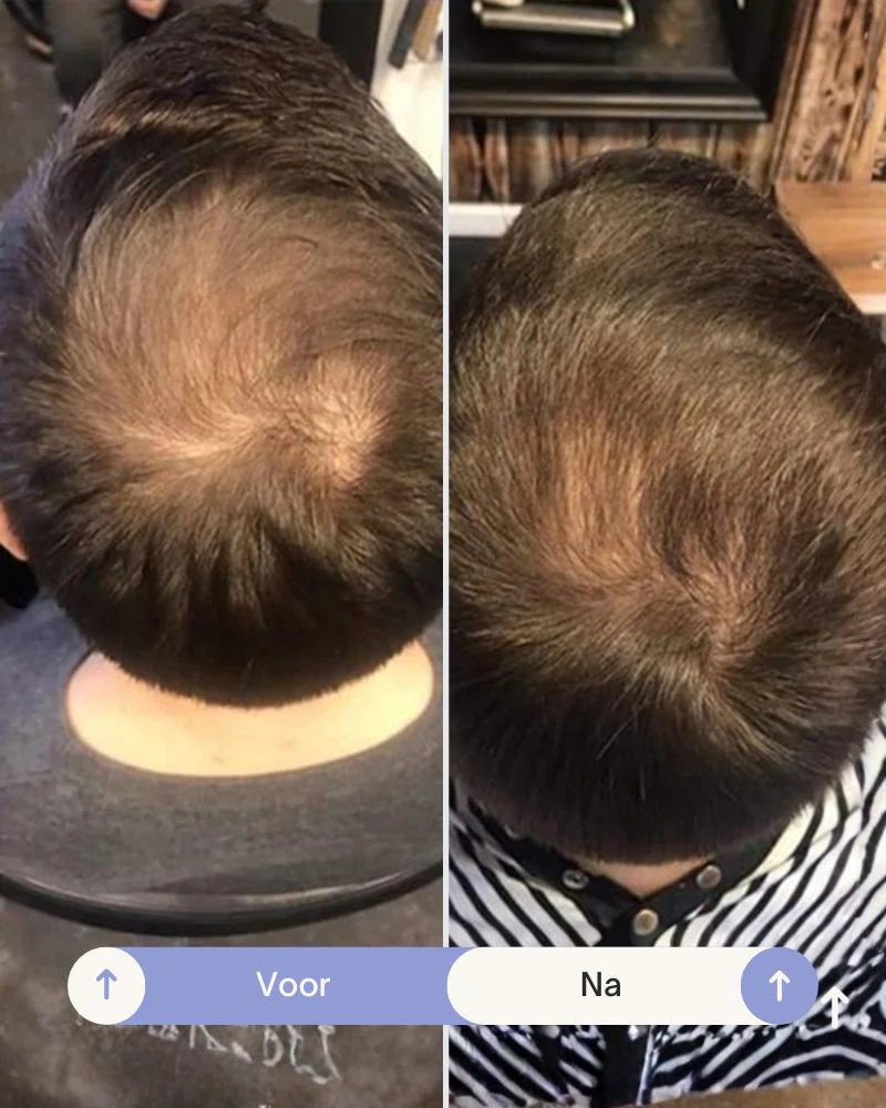 Grow Perfect™ Shampoo - Image 7