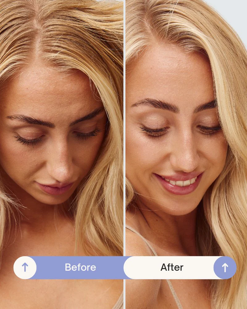 Refresh Powder™ Dry Shampoo - Image 4