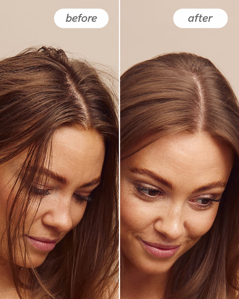 Scalp Delight™ Detox Conditioner - Image 5